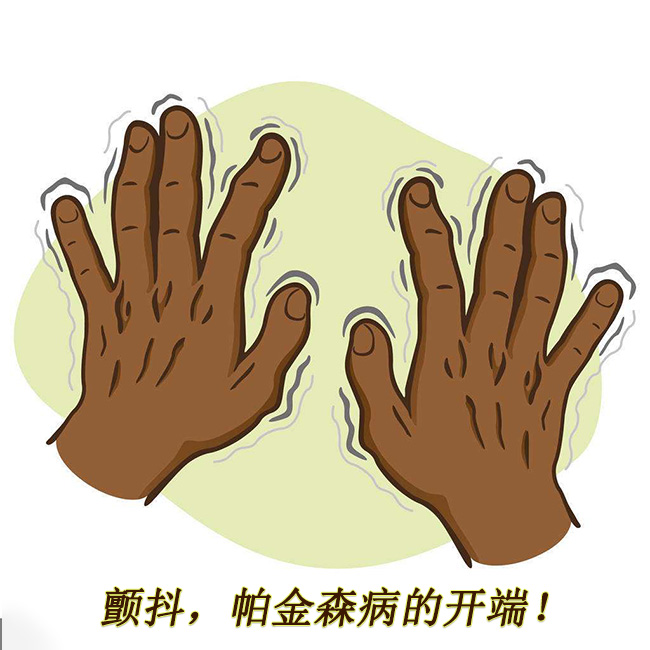 顫抖，帕金森病的開端 帕金森的早期癥狀